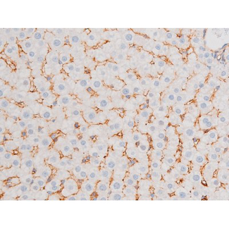 FOXO4 / AFX1 Antibody - 1:200 staining rat liver tissue by IHC-P. The tissue was formaldehyde fixed and a heat mediated antigen retrieval step in citrate buffer was performed. The tissue was then blocked and incubated with the antibody for 1.5 hours at 22°C. An HRP conjugated goat anti-rabbit antibody was used as the secondary.