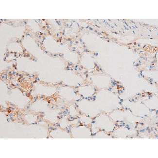 FOXO4 / AFX1 Antibody - 1:200 staining rat lung tissue by IHC-P. The tissue was formaldehyde fixed and a heat mediated antigen retrieval step in citrate buffer was performed. The tissue was then blocked and incubated with the antibody for 1.5 hours at 22°C. An HRP conjugated goat anti-rabbit antibody was used as the secondary.