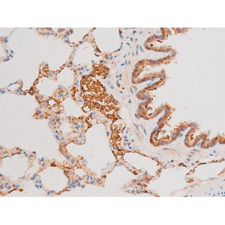 FOXO4 / AFX1 Antibody - 1:200 staining rat lung tissue by IHC-P. The tissue was formaldehyde fixed and a heat mediated antigen retrieval step in citrate buffer was performed. The tissue was then blocked and incubated with the antibody for 1.5 hours at 22°C. An HRP conjugated goat anti-rabbit antibody was used as the secondary.