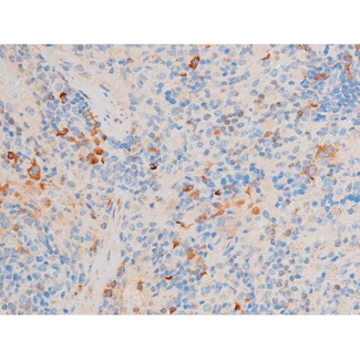 FOXO4 / AFX1 Antibody - 1:200 staining rat spleen tissue by IHC-P. The tissue was formaldehyde fixed and a heat mediated antigen retrieval step in citrate buffer was performed. The tissue was then blocked and incubated with the antibody for 1.5 hours at 22°C. An HRP conjugated goat anti-rabbit antibody was used as the secondary.