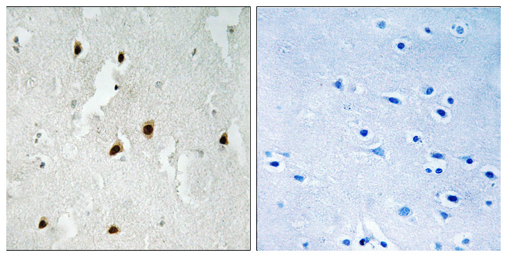 FOXO4 / AFX1 Antibody - Immunohistochemistry analysis of paraffin-embedded human brain, using FOXO4 (Phospho-Ser262) Antibody. The picture on the right is blocked with the phospho peptide.