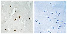 FOXO4 / AFX1 Antibody - Immunohistochemistry analysis of paraffin-embedded human brain, using FOXO4 (Phospho-Ser262) Antibody. The picture on the right is blocked with the phospho peptide.