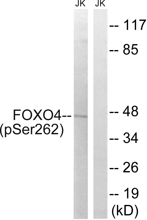 FOXO4 / AFX1 Antibody - Western blot analysis of lysates from Jurkat cells treated with starved 24h, using FOXO4 (Phospho-Ser262) Antibody. The lane on the right is blocked with the phospho peptide.