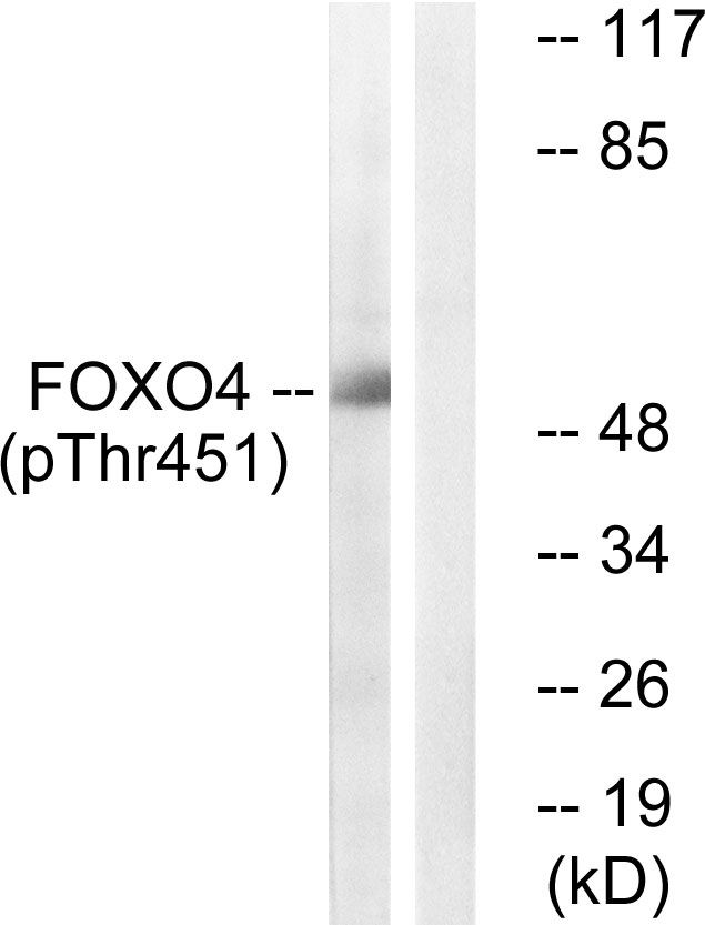 FOXO4 / AFX1 Antibody - Western blot analysis of lysates from HUVEC cells treated with EGF 200ng/ml 5', using FOXO4 (Phospho-Thr451) Antibody. The lane on the right is blocked with the phospho peptide.