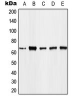 FOXO4 / AFX1 Antibody - Western blot analysis of FOXO4 (pT451) expression in THP1 EGF-treated (A); K562 (B); Jurkat (C); NIH3T3 (D); mouse lung (E) whole cell lysates.