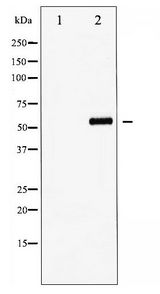 FOXO4 / AFX1 Antibody - Western blot of FOXO4 phosphorylation expression in EGF treated HUVEC whole cell lysates,The lane on the left is treated with the antigen-specific peptide.