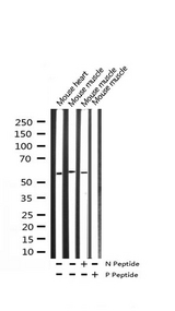 FOXO4 / AFX1 Antibody - Western blot analysis of Phospho-FOXO4 (Thr451) expression in various lysates