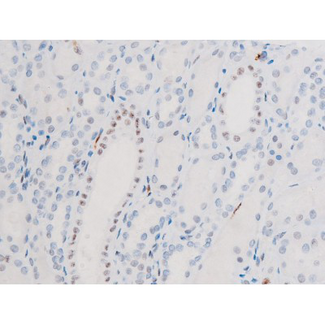 FOXO4 / AFX1 Antibody - 1:200 staining human kidney tissue by IHC-P. The tissue was formaldehyde fixed and a heat mediated antigen retrieval step in citrate buffer was performed. The tissue was then blocked and incubated with the antibody for 1.5 hours at 22°C. An HRP conjugated goat anti-rabbit antibody was used as the secondary.