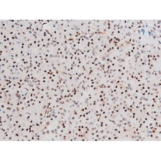 FOXO4 / AFX1 Antibody - 1:200 staining human pancreas tissue by IHC-P. The tissue was formaldehyde fixed and a heat mediated antigen retrieval step in citrate buffer was performed. The tissue was then blocked and incubated with the antibody for 1.5 hours at 22°C. An HRP conjugated goat anti-rabbit antibody was used as the secondary.