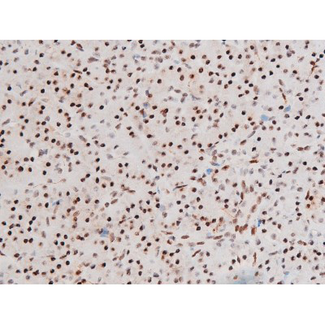 FOXO4 / AFX1 Antibody - 1:200 staining human pancreas tissue by IHC-P. The tissue was formaldehyde fixed and a heat mediated antigen retrieval step in citrate buffer was performed. The tissue was then blocked and incubated with the antibody for 1.5 hours at 22°C. An HRP conjugated goat anti-rabbit antibody was used as the secondary.
