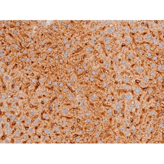 FOXO4 / AFX1 Antibody - 1:200 staining mouse liver tissue by IHC-P. The tissue was formaldehyde fixed and a heat mediated antigen retrieval step in citrate buffer was performed. The tissue was then blocked and incubated with the antibody for 1.5 hours at 22°C. An HRP conjugated goat anti-rabbit antibody was used as the secondary.