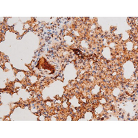FOXO4 / AFX1 Antibody - 1:200 staining mouse lung tissue by IHC-P. The tissue was formaldehyde fixed and a heat mediated antigen retrieval step in citrate buffer was performed. The tissue was then blocked and incubated with the antibody for 1.5 hours at 22°C. An HRP conjugated goat anti-rabbit antibody was used as the secondary.