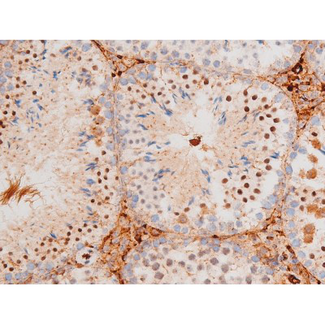 FOXO4 / AFX1 Antibody - 1:200 staining mouse testis tissue by IHC-P. The tissue was formaldehyde fixed and a heat mediated antigen retrieval step in citrate buffer was performed. The tissue was then blocked and incubated with the antibody for 1.5 hours at 22°C. An HRP conjugated goat anti-rabbit antibody was used as the secondary.