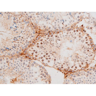 FOXO4 / AFX1 Antibody - 1:200 staining mouse testis tissue by IHC-P. The tissue was formaldehyde fixed and a heat mediated antigen retrieval step in citrate buffer was performed. The tissue was then blocked and incubated with the antibody for 1.5 hours at 22°C. An HRP conjugated goat anti-rabbit antibody was used as the secondary.
