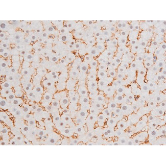 FOXO4 / AFX1 Antibody - 1:200 staining rat liver tissue by IHC-P. The tissue was formaldehyde fixed and a heat mediated antigen retrieval step in citrate buffer was performed. The tissue was then blocked and incubated with the antibody for 1.5 hours at 22°C. An HRP conjugated goat anti-rabbit antibody was used as the secondary.