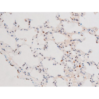 FOXO4 / AFX1 Antibody - 1:200 staining rat lung170826 tissue by IHC-P. The tissue was formaldehyde fixed and a heat mediated antigen retrieval step in citrate buffer was performed. The tissue was then blocked and incubated with the antibody for 1.5 hours at 22°C. An HRP conjugated goat anti-rabbit antibody was used as the secondary.