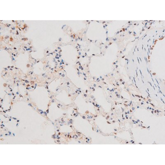 FOXO4 / AFX1 Antibody - 1:200 staining rat lung170826 tissue by IHC-P. The tissue was formaldehyde fixed and a heat mediated antigen retrieval step in citrate buffer was performed. The tissue was then blocked and incubated with the antibody for 1.5 hours at 22°C. An HRP conjugated goat anti-rabbit antibody was used as the secondary.