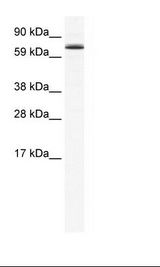 FOXO6 Antibody - SP2/0 Cell Lysate.  This image was taken for the unconjugated form of this product. Other forms have not been tested.