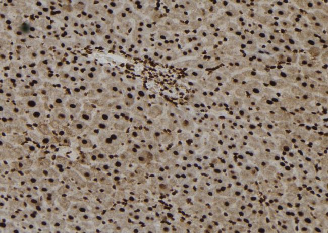 FOXO6 Antibody - 1:100 staining mouse liver tissue by IHC-P. The sample was formaldehyde fixed and a heat mediated antigen retrieval step in citrate buffer was performed. The sample was then blocked and incubated with the antibody for 1.5 hours at 22°C. An HRP conjugated goat anti-rabbit antibody was used as the secondary.