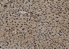 FOXO6 Antibody - 1:100 staining mouse liver tissue by IHC-P. The sample was formaldehyde fixed and a heat mediated antigen retrieval step in citrate buffer was performed. The sample was then blocked and incubated with the antibody for 1.5 hours at 22°C. An HRP conjugated goat anti-rabbit antibody was used as the secondary.