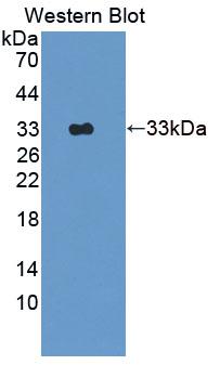 FOXP1 Antibody - Western Blot; Sample: Recombinant protein.