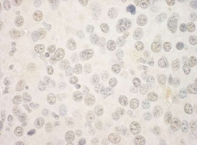 FOXP1 Antibody - Detection of Mouse FOXP1 by Immunohistochemistry. Sample: FFPE section of mouse hybridoma tumor. Antibody: Affinity purified rabbit anti-FOXP1 used at a dilution of 1:250.