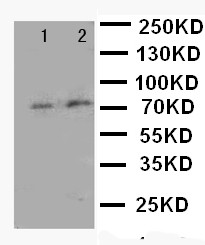 FOXP1 Antibody - WB of FOXP1 antibody. Lane 1: Rat Spleen Tissue Lysate. Lane 2: COLO320 Cell Lysate.