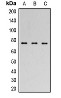 FOXP1 Antibody - Western blot analysis of FOXP1 expression in SHSY5Y (A); HEK293T (B); NIH3T3 (C) whole cell lysates.