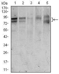 FOXP1 Antibody - Western blot using FOXP1 mouse monoclonal antibody against HeLa (1), Jurkat (2), MCF-7 (3), T47D (4), and Raw264.7 (5) cell lysate.