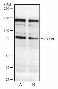 FOXP1 Antibody - Western Blot: FOXP1 Antibody (JC12) - Western blot analysis of resonicated MCF7 cell lysate (A) and MCF7 cell lysate (B) using FOXP1 antibody at 2 ug/ml.