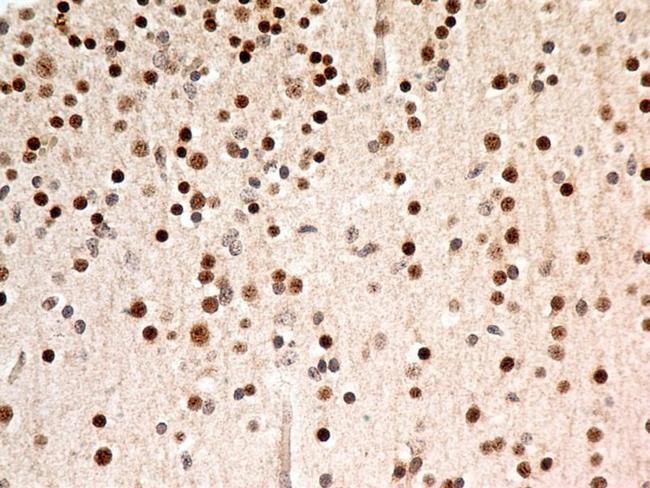 FOXP1 Antibody - Immunohistochemistry-Paraffin: FOXP1 Antibody (JC12) - IHC analysis of formalin-fixed paraffin-embedded tissue section of human normal brain using mouse monoclonal FOXP1 antibody (clone JC12) at 5 ug/ml concentration. The cells in the brain tissue depicted strong specific nuclear along with relatively weak cytoplasmic immunopositivity for FOXP1 protein.