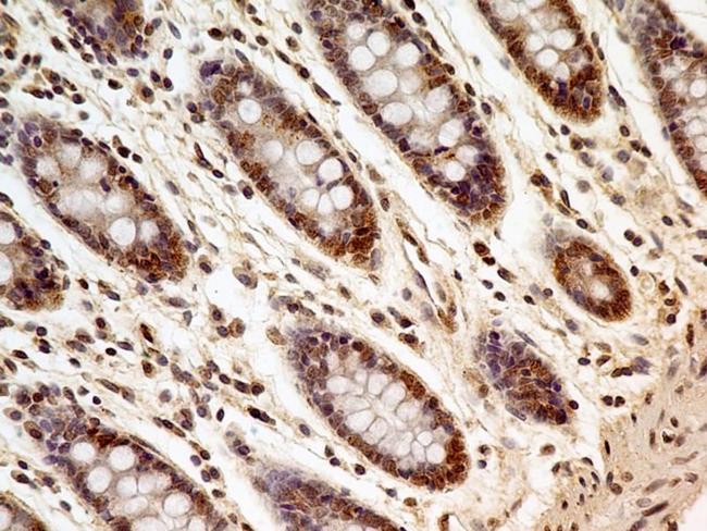 FOXP1 Antibody - Immunohistochemistry-Paraffin: FOXP1 Antibody (JC12) - IHC analysis of formalin-fixed paraffin-embedded tissue section of human normal colon using mouse monoclonal FOXP1 antibody (clone JC12) at 5 ug/ml concentration. Most of the cells depicted an expected strong nuclear with mild cytoplasmic staining.