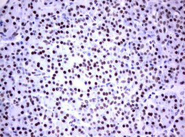 FOXP1 Antibody - IHC of paraffin-embedded Human pancreas tissue using anti-FOXP1 mouse monoclonal antibody. (heat-induced epitope retrieval by 1 mM EDTA in 10mM Tris, pH8.5, 120°C for 3min).