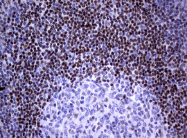 FOXP1 Antibody - IHC of paraffin-embedded Human tonsil using anti-FOXP1 mouse monoclonal antibody. (heat-induced epitope retrieval by 1 mM EDTA in 10mM Tris, pH8.5, 120°C for 3min).