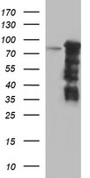 FOXP1 Antibody - HEK293T cells were transfected with the pCMV6-ENTRY control (Left lane) or pCMV6-ENTRY FOXP1 (Right lane) cDNA for 48 hrs and lysed. Equivalent amounts of cell lysates (5 ug per lane) were separated by SDS-PAGE and immunoblotted with anti-FOXP1.