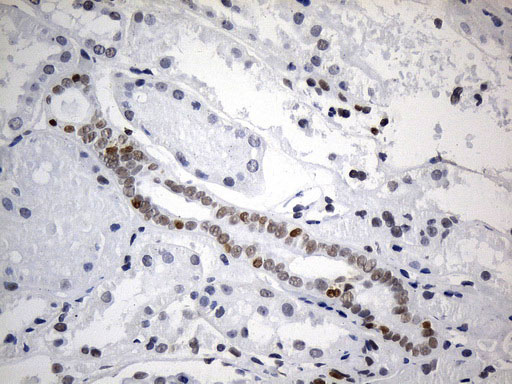 FOXP1 Antibody - Immunohistochemical staining of paraffin-embedded Human Kidney tissue within the normal limits using anti-FOXP1 mouse monoclonal antibody. (Heat-induced epitope retrieval by 1mM EDTA in 10mM Tris buffer. (pH8.5) at 120°C for 3 min. (1:75)