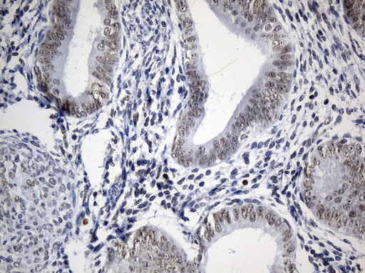 FOXP1 Antibody - Immunohistochemical staining of paraffin-embedded Human endometrium tissue within the normal limits using anti-FOXP1 mouse monoclonal antibody. (Heat-induced epitope retrieval by 1mM EDTA in 10mM Tris buffer. (pH8.5) at 120°C for 3 min. (1:75)