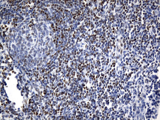 FOXP1 Antibody - Immunohistochemical staining of paraffin-embedded Human lymph node tissue within the normal limits using anti-FOXP1 mouse monoclonal antibody. (Heat-induced epitope retrieval by 1mM EDTA in 10mM Tris buffer. (pH8.5) at 120°C for 3 min. (1:75)