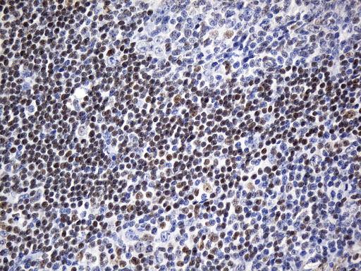FOXP1 Antibody - Immunohistochemical staining of paraffin-embedded Human tonsil within the normal limits using anti-FOXP1 mouse monoclonal antibody. (Heat-induced epitope retrieval by 1mM EDTA in 10mM Tris buffer. (pH8.5) at 120°C for 3 min. (1:75)