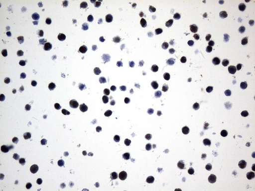FOXP1 Antibody - Immunohistochemical staining of paraffin-embedded A375 cell pellets using anti-FOXP1 mouse monoclonal antibody. (Heat-induced epitope retrieval by 1mM EDTA in 10mM Tris buffer. (pH8.0) at 120°C for 2.5 min,