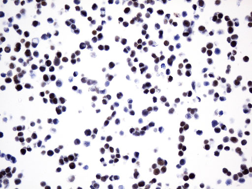 FOXP1 Antibody - Immunohistochemical staining of paraffin-embedded LoVo cell pellets using anti-FOXP1 mouse monoclonal antibody. (Heat-induced epitope retrieval by 1mM EDTA in 10mM Tris buffer. (pH8.0) at 120°C for 2.5 min(1:75)