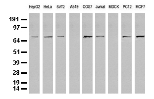 FOXP1 Antibody - Western blot analysis of extracts. (35ug) from 9 different cell lines by using anti-FOXP1 monoclonal antibody. (Clone UMAB89).