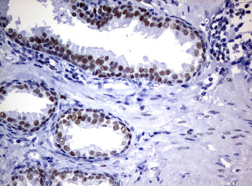 FOXP1 Antibody - Immunohistochemical staining of paraffin-embedded Human prostate tissue using anti-FOXP1 mouse monoclonal antibody.  heat-induced epitope retrieval by 1 mM EDTA in 10mM Tris, pH8.0, 120C for 3min)