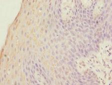 FOXP1 Antibody - Immunohistochemistry of paraffin-embedded human tonsil tissue using FOXP1 Antibody at dilution of 1:100