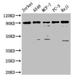 FOXP1 Antibody - Western Blot Positive WB detected in: Jurkat whole cell lysate, A549 whole cell lysate, MCF-7 whole cell lysate, PC-3 whole cell lysate, Raji whole cell lysate All lanes: FOXP1 antibody at 4µg/ml Secondary Goat polyclonal to rabbit IgG at 1/50000 dilution Predicted band size: 76, 55, 66, 75, 13, 67, 68 kDa Observed band size: 85 kDa