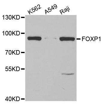 FOXP1 Antibody - Western blot analysis of extracts of various cell lines.