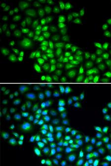 FOXP1 Antibody - Immunofluorescence analysis of U20S cells.