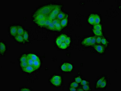 FOXP1 Antibody - Immunofluorescent analysis of PC-3 cells using FOXP1 Antibody at dilution of 1:100 and Alexa Fluor 488-congugated AffiniPure Goat Anti-Rabbit IgG(H+L)