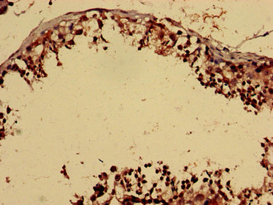 FOXP1 Antibody - Immunohistochemistry analysis of human testis tissue using FOXP1 Antibody at dilution of 1:100