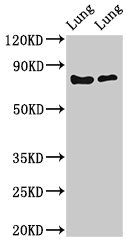 FOXP1 Antibody - Western Blot Positive WB detected in: Rat lung tissue, Mouse lung tissue All lanes: FOXP1 antibody at 2µg/ml Secondary Goat polyclonal to rabbit IgG at 1/50000 dilution Predicted band size: 76, 55, 66, 75, 13, 67, 78 kDa Observed band size: 76 kDa